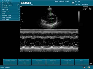 EDAN U50