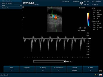 EDAN U50 VET