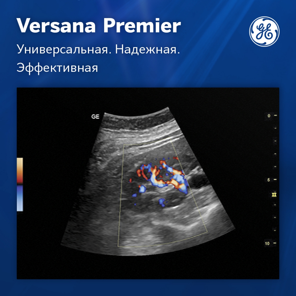 GE Versana Premier black