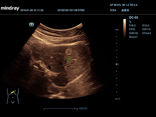 Mindray DC-55