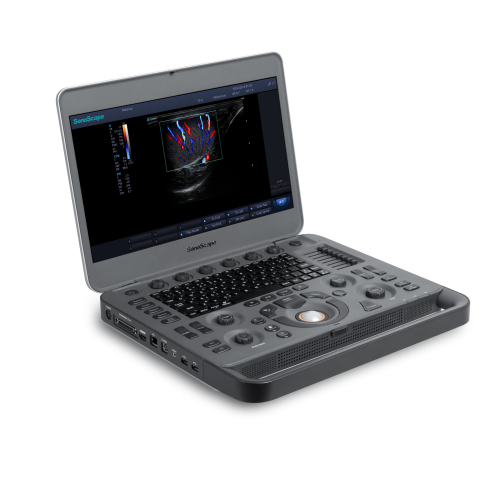 SonoScape S2N vet